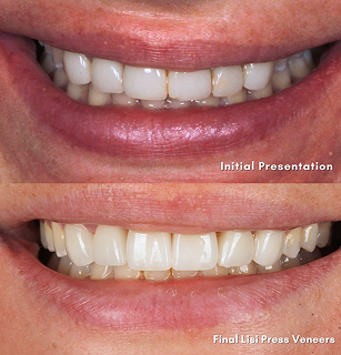 BOOM Smiles Facebook Post 2